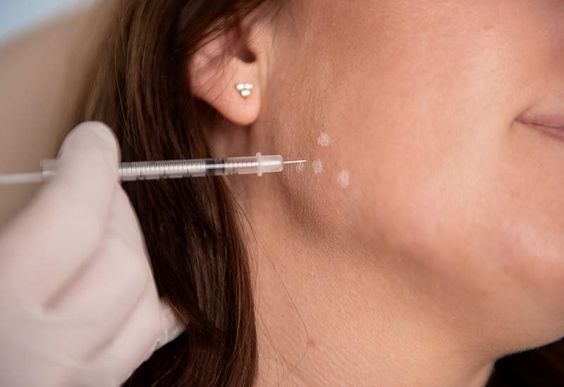 Behandeling tanden knarsen - Patrice Visser kliniek