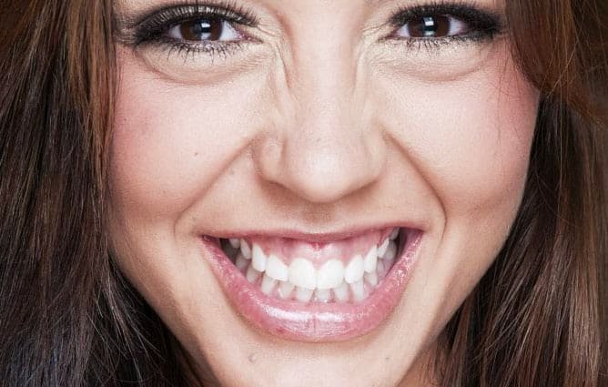 Behandelindicatie gummy smile