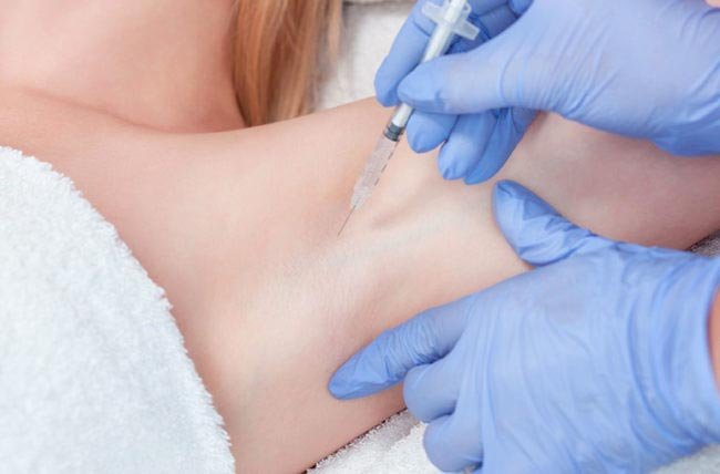 Behandeling overmatig transpireren