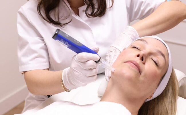 Skinpen behandeling